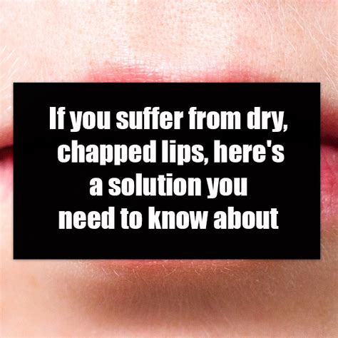 If You Suffer From Dry Chapped Lips Heres A Solution You Need To