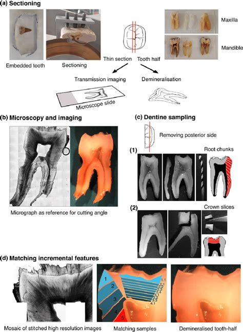 Dentine Serial Sampling Workflow A Sectioning Bisecting The Tooth