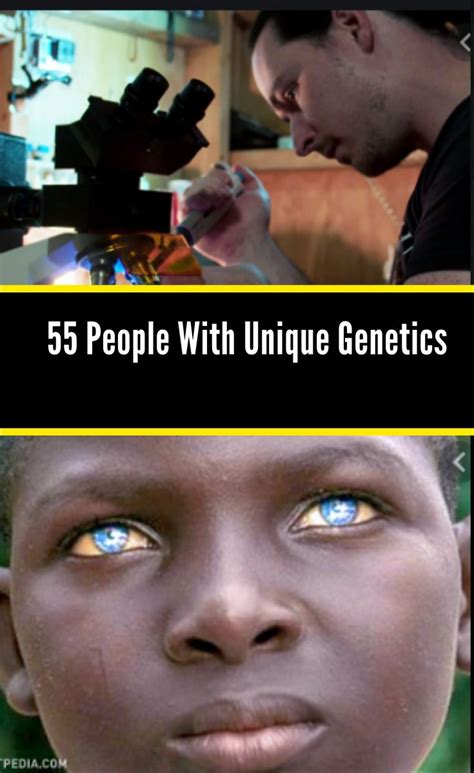 55 People Whose Genetics Make Them Look Incredibly Unique Genetics