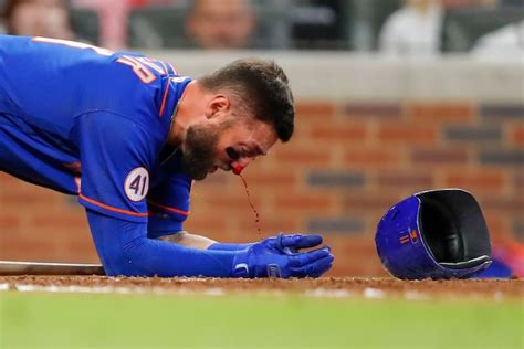 Mets Kevin Pillar Hit In The Face By Pitch In ‘scary Bloody Scene
