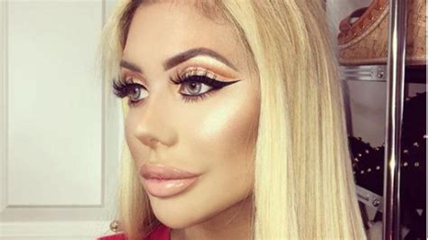Chloe Ferry Hits Back At Haters Who Criticised Her Surgery And Is