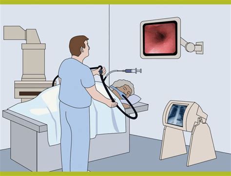 内镜下逆行胰胆管造影术（ercp）的前生今世技术