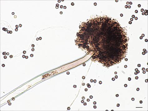 Aspergillus (/ˌæspərˈdʒɪləs/) is a genus consisting of a few hundred mould species found in various climates worldwide. Evaluation of Biocompatibility of Chitosan Films from the ...