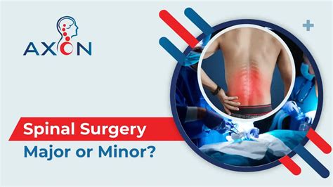 The Truth About Spinal Surgery Major Or Minor