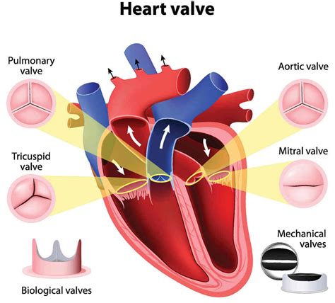Mitral Valve And Aortic Valve