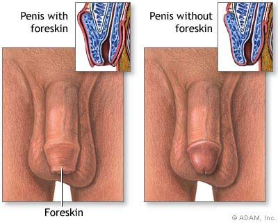 Circumcised Vs Uncircumcised Penis Sex My Xxx Hot Girl