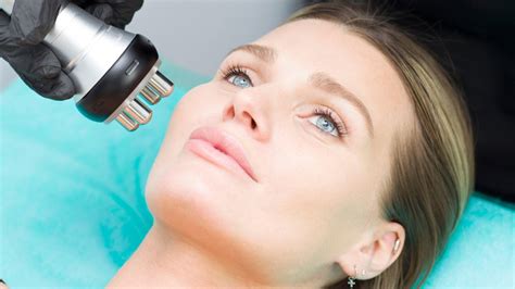 Everything You Wanted To Know About Radiofrequency Skin Tightening