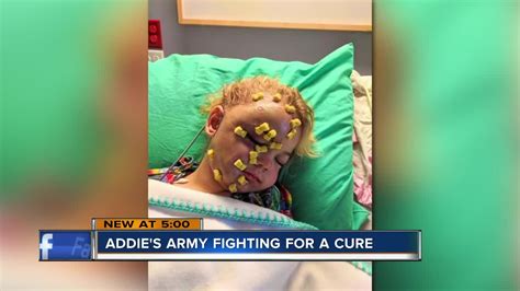Packers Party Benefits Year Old Battling Rare Disease