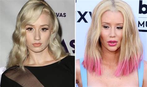 Stylish Blonde The Most Obvious Celebrity Plastic Surgeries Najbardziej Znane I Najmniej Udane