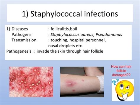 Lecture 3 Diseases Caused By Bacterial Infection