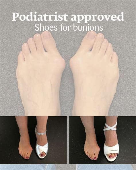 Pin On How To Find Stylish Shoes For Bunions