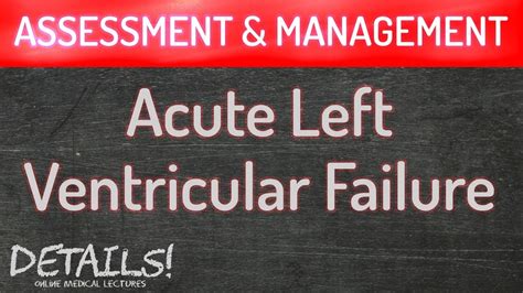 Acute Left Ventricular Failure Assessment And Management Details