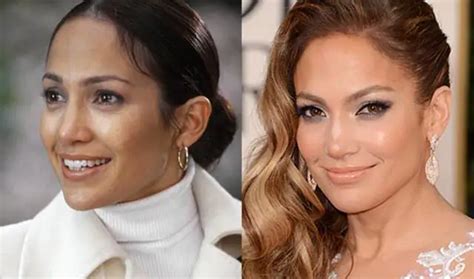 Jennifer Lopez Nose Job Plastic Surgery Before And After Celebie