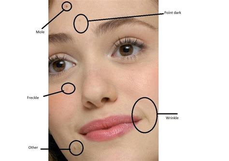 Mole on upper lip meaning male. , Examples of facial marks Scar, mole, and freckles etc ...