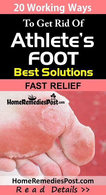 20 Home Remedies For Athletes Foot That Work Naturally Fast Herbal