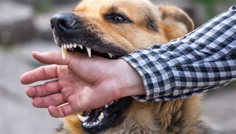 Tips To Prevent Dog Bite Injuries General Magazine