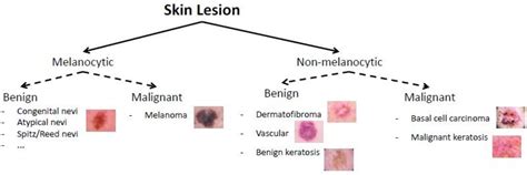 Figure 1 From Enhanced Skin Lesions Classification Using Deep