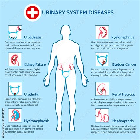 Urinary System Diseases Medical Infographics Of Urinary System Vector