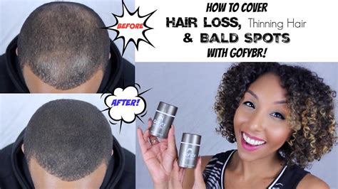 How To Cover Up Hair Loss Thinning Hair And Bald Spots Wgofybr