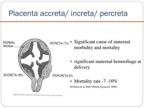 Ppt Placenta Accreta Lessons Learnt Powerpoint Presentation Free