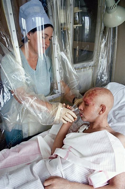 This site contains information about chernobyl radiation victims. Chernobyl radiation burns victim - Stock Image - C009/0588 - Science Photo Library