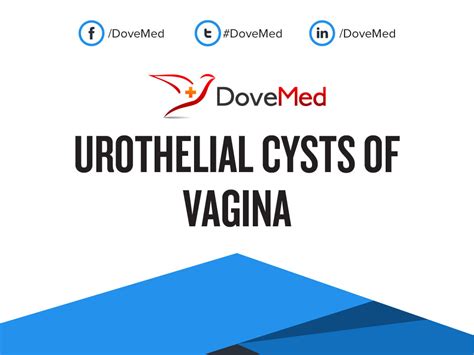 urothelial cysts of vagina