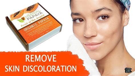 Remove Acne Scars Dark Spots And Skin Discoloration With One Soap