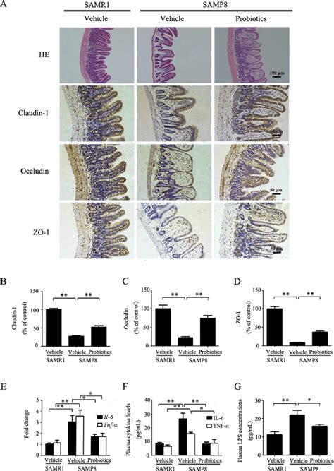 Effects Of ProBiotic 4 Treatment On Intestinal Tight Junction Proteins
