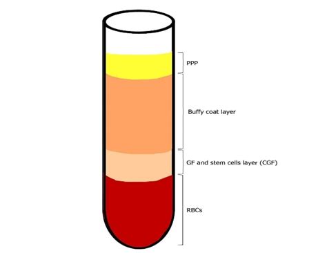 Blood Centrifugation After Collection At The End Of The Centrifugation