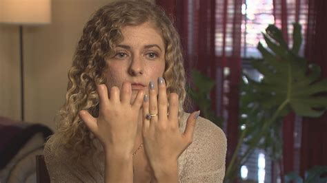 how woman with untreated strep throat is coping after losing fingers and toes acordes chordify