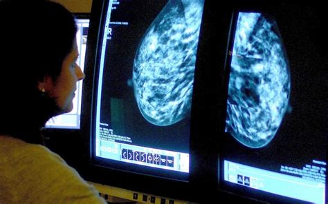 Breast Cancer Screening Should Begin At 35 After Trial Shows It Could