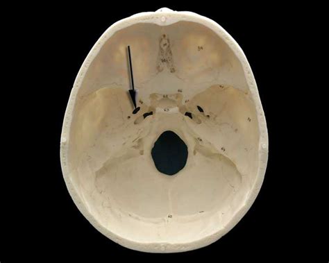 New Photos In Foramen Ovale Anatomy