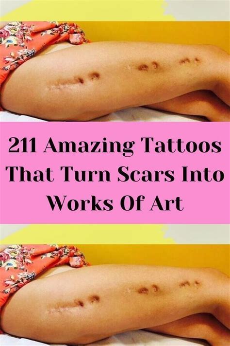 211 Amazing Tattoos That Turn Scars Into Works Of Art Artofit