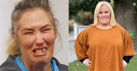 Mama June Fans Wonder Where She Got 75000 For Plastic Surgery Amid