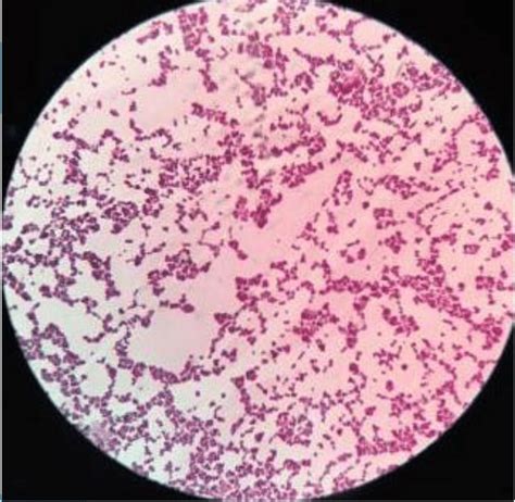 Staphylococcus Aureus Under Microscope 100x Micropedia