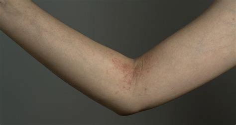 7 Causes Of Skin Rashes You Might Not Know About