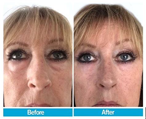 Original Facelift In A Bottle Look 10 Years Younger Instantly Puffy