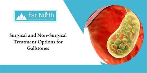 Surgical And Non Surgical Treatment Options For Gallstones