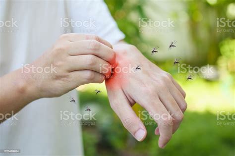 Man Itching And Scratching On Hand From Allergy Skin Rash Cause By