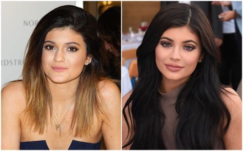 May be, may be not! Kylie Jenner After & Before Pictures: Did She Do Surgery ...