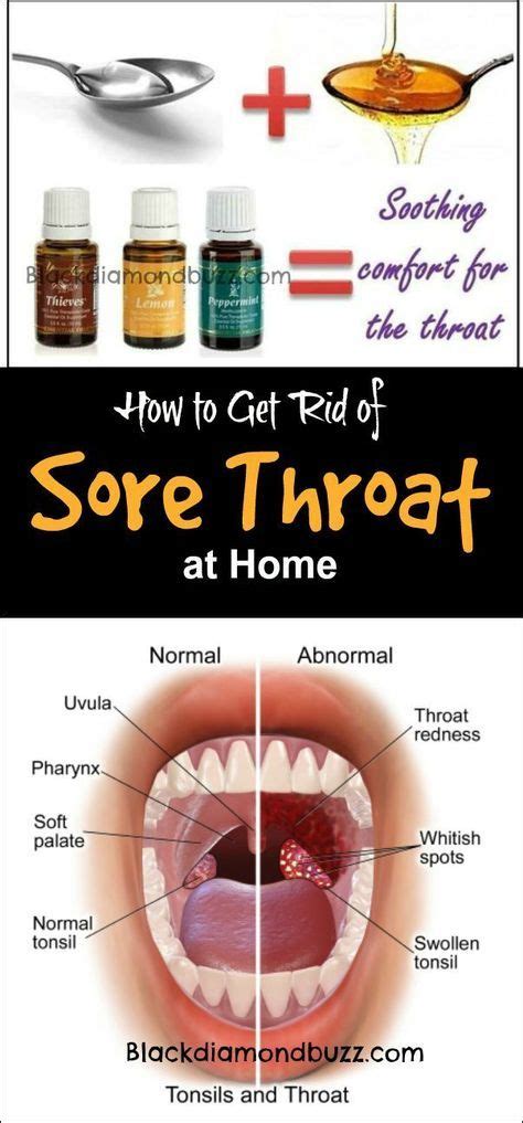 sore throat remedies how to get rid of sore throat fast at home using essential oil honey and