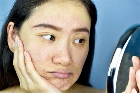 Causes Of Dead Skin Cells Build Up
