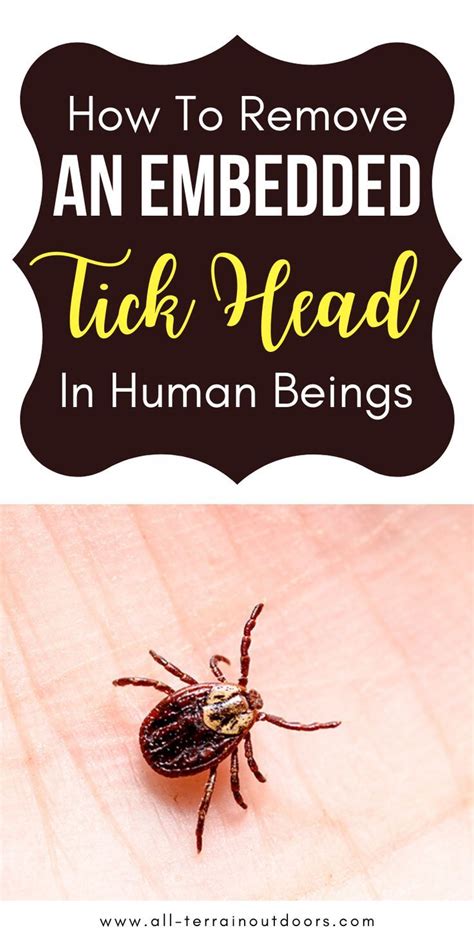 How To Remove An Embedded Tick Head In Human Beings In 2020 Ticks