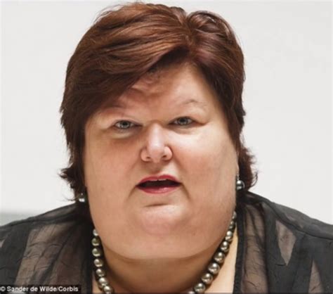 I forget what country, but another countries' equivalent of it's health minister is also obese and is a physician. Critic's Attack on Health Minister of Belgium for Being ...
