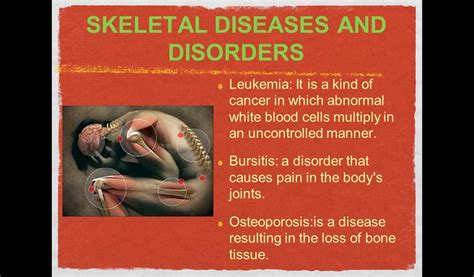 Skeletal And Muscular Diseases