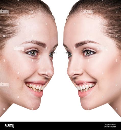 Young Woman Before And After Retouch Stock Photo Alamy