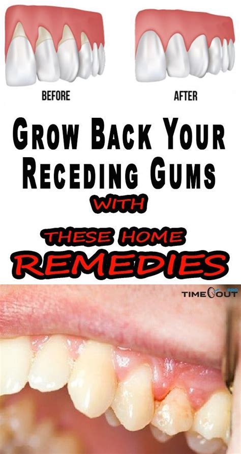 All The Oral Hygiene Tips You Need To Know Gum Health Receding Gums
