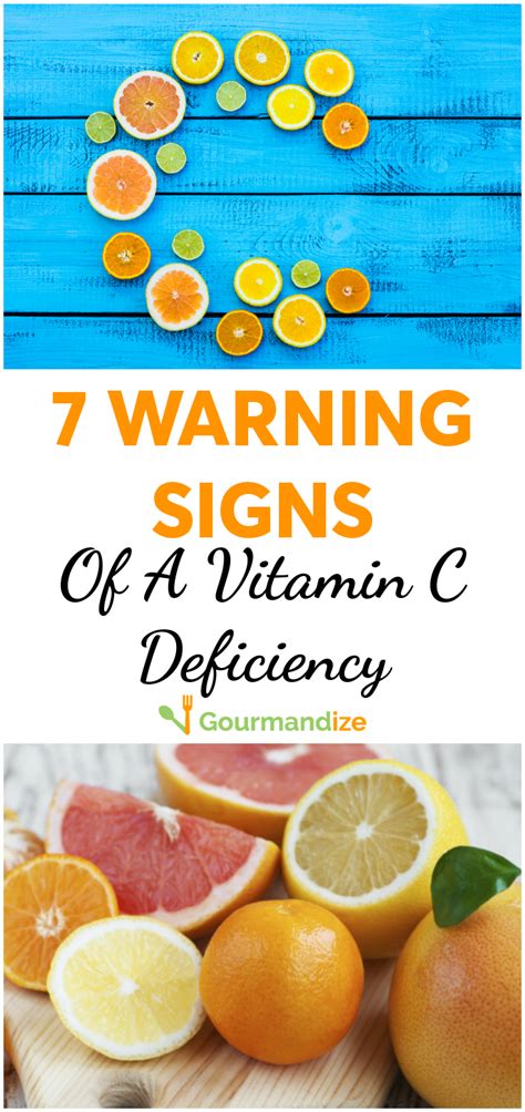 Signs You Have A Vitamin C Deficiency Vitamin C Health And