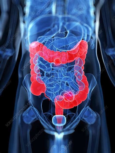 Healthy Large Intestines Artwork Stock Image F0047882 Science