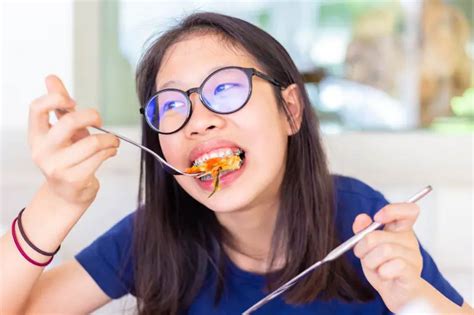 Food To Avoid With Braces The Surprising Things You Cant Eat With Braces Braces Journey